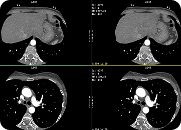 DICOM Image Management (CT, X-ray)